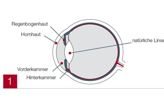 Auge beschriftet (ICL)