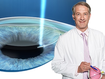 ReLEx smile statt LASIK mit Dr. Lerche