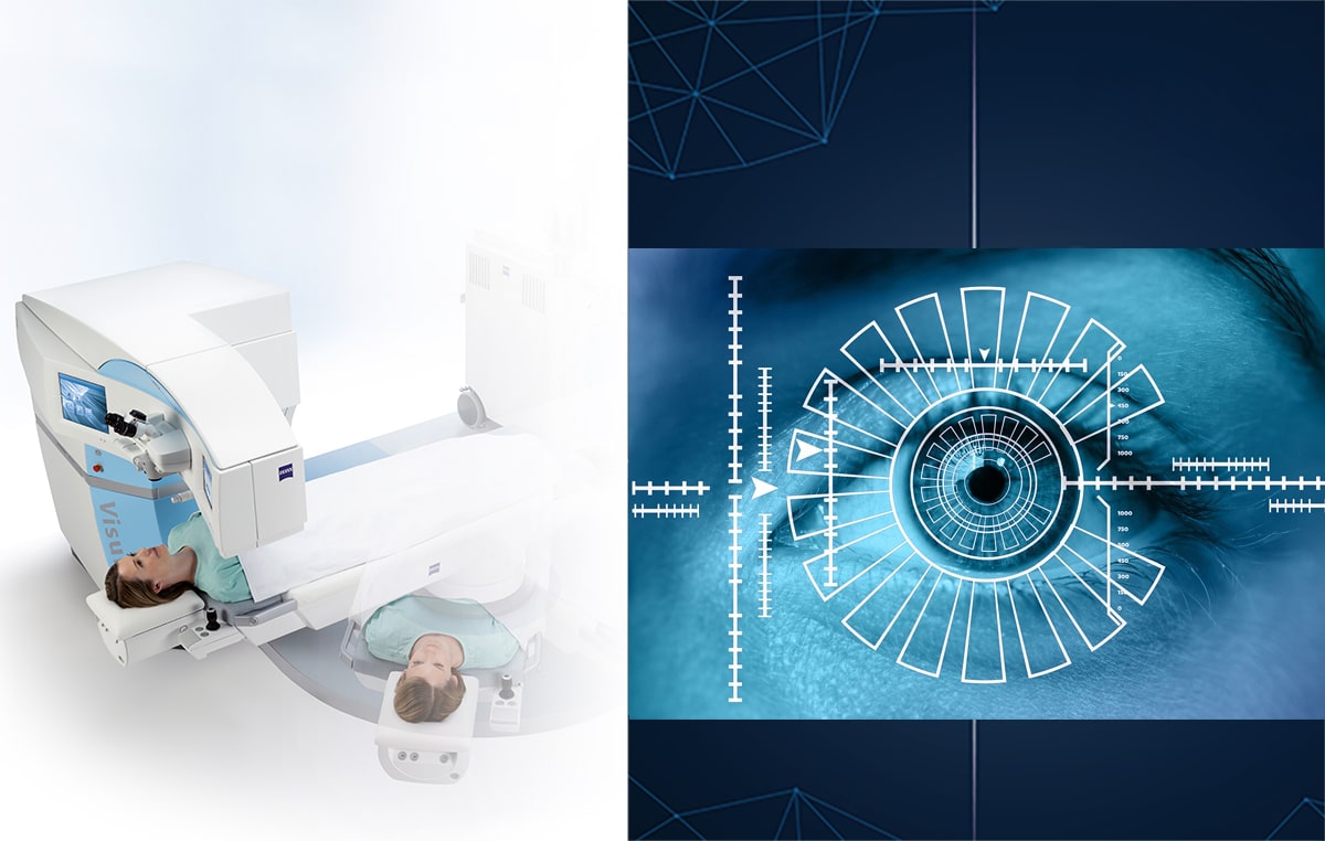 Robotic Eye Surgery – Ein Überblick