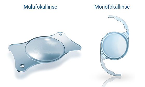 Multifokallinse & Monofokallinse