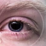 augenprobleme