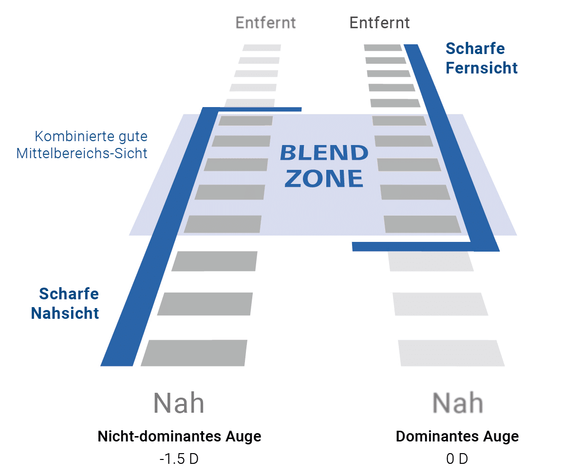 Presbyond Blend-Zone