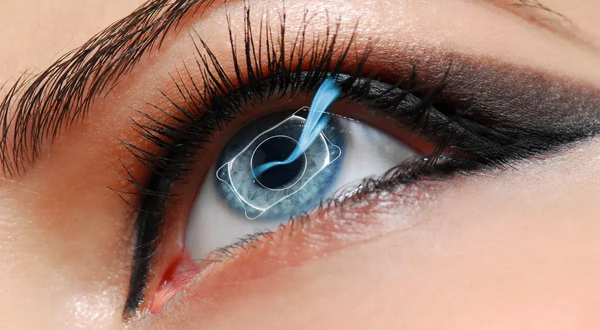 Auge-ICL-mit-Centra-Flow Auge ICL mit Centra Flow