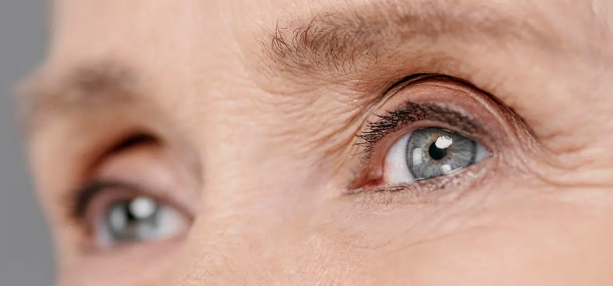Light-Adjustable-Lens-bei-Makula-Degeneration-Motiv-Augen-aeltere-Frau Light Adjustable Lens bei Makula Degeneration Motiv Augen aeltere Frau